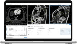 Corsmed Interface – Laptop Cardiac