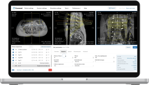 Corsmed Interface – Laptop Lumbar Spine