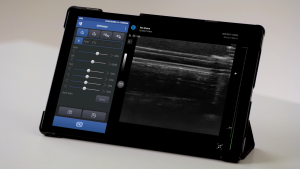 Arterial Puncture Wrist 13
